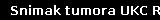 Snimak tumora UKC RS
