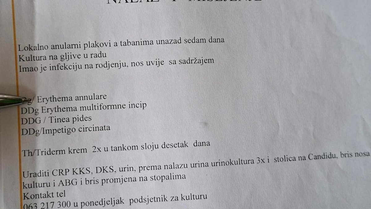 Alergija na vakcinu 