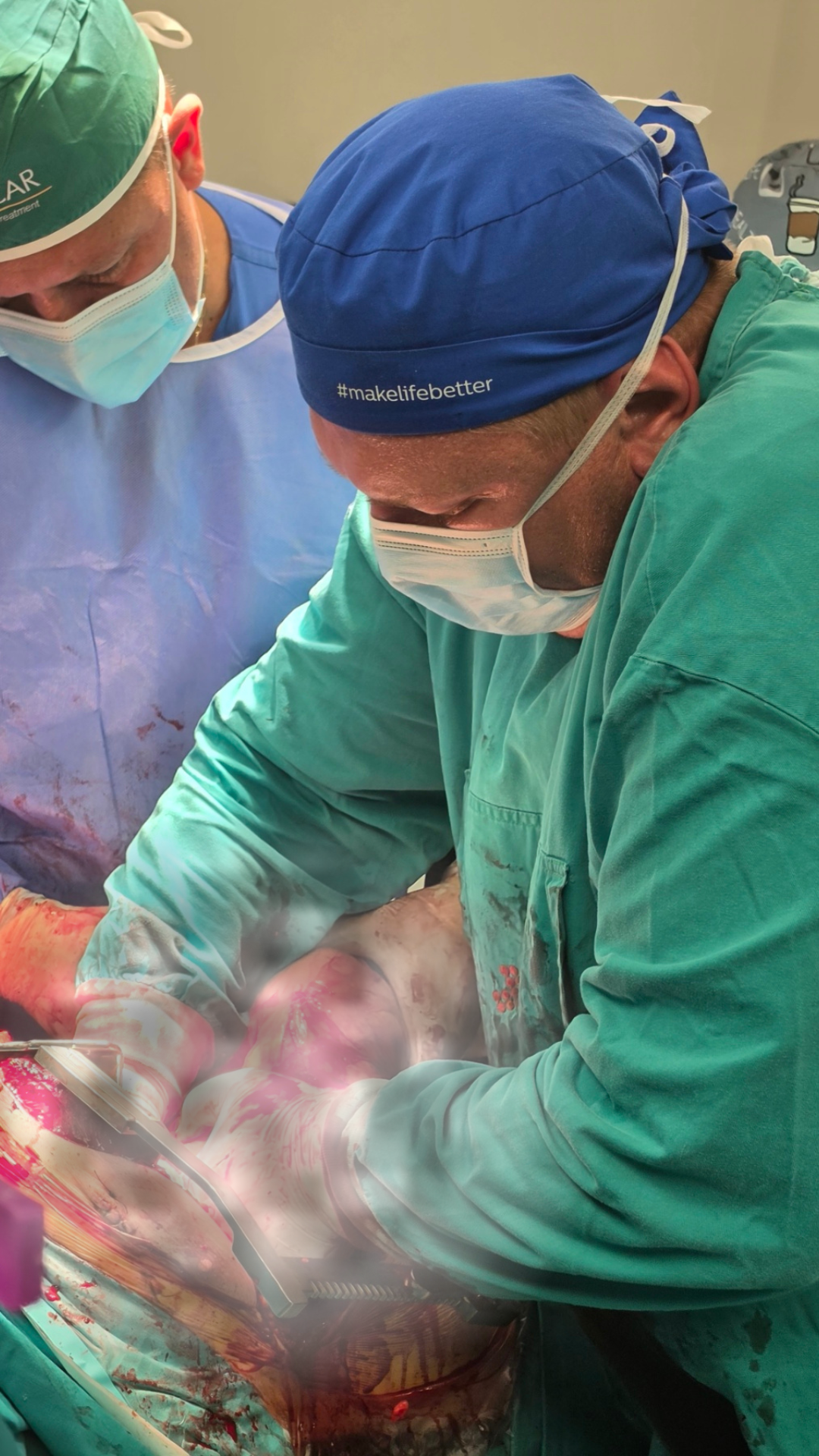 Dr Simetic - Operacija tumora od 6 kilograma