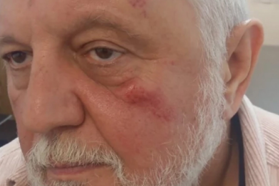 TUKAO ME JE ZBOG DARE IZ JASENOVCA, BJELOGRLIĆ JE KORUPCIONAŠ Detalji brutalnog prebijanja Gage Antonijevića