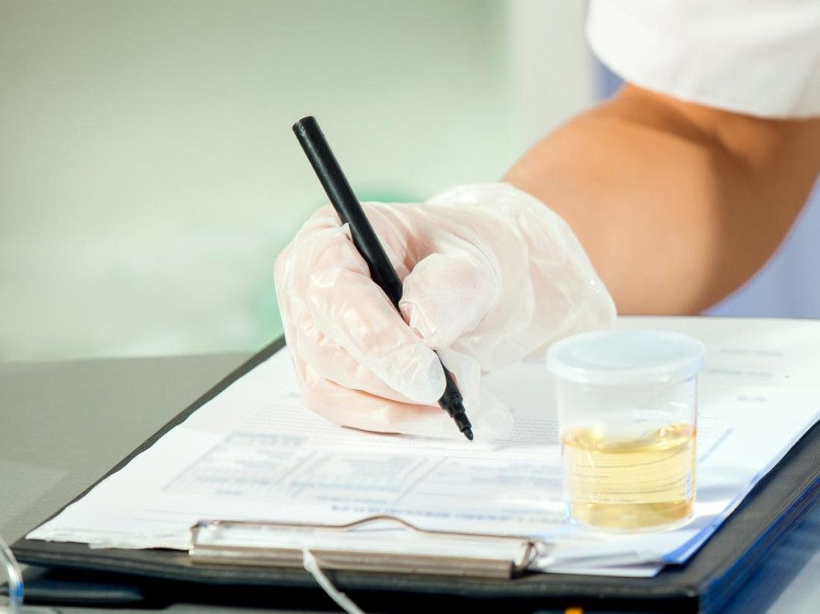 NEDOSTATAK RADNE SNAGE prisiljava kompanije da prestanu testirati svoje zaposlenike na droge