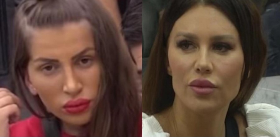NI MAJKE IH NE BI PREPOZNALE! Isplivale fotografije Stanije i Dalile prije svih operacija!