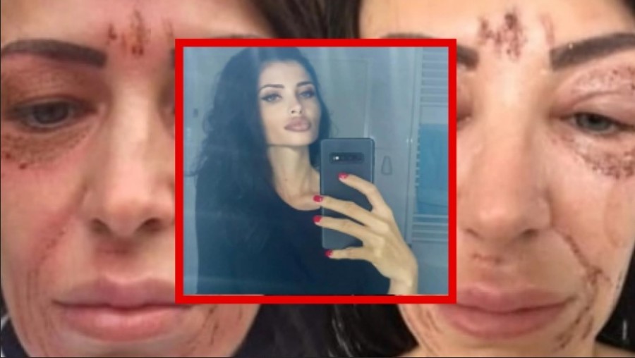 "BARBI DOKTORKA" NE PRIZNAJE KRIVICU Novo suđenje Olgici Markanović