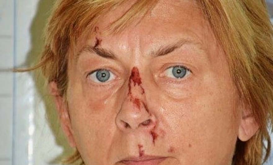 JAVILI SE ČEŠKI TURISTI, tvrde da je žena s Krka Slovakinja i da su se družili s njom
