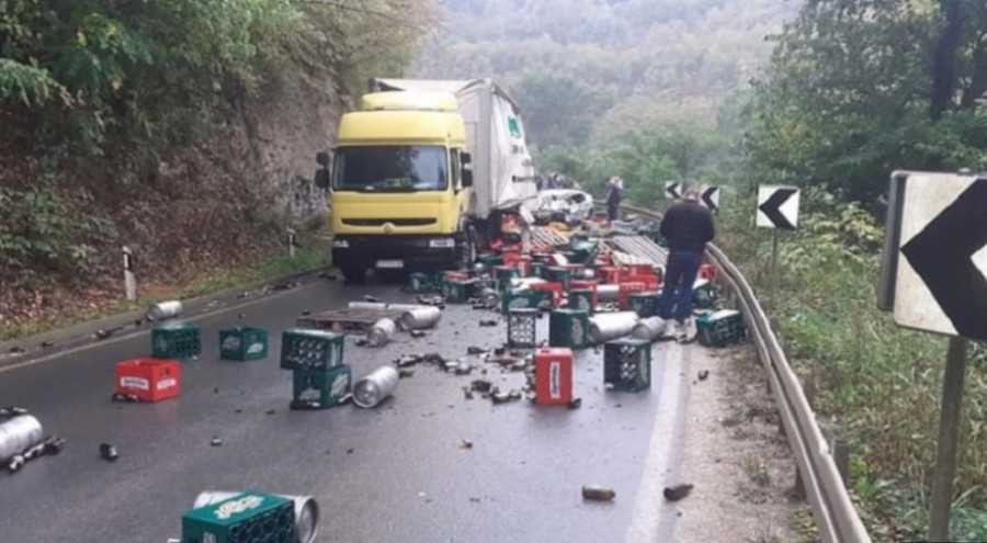 "MOJ NOS, MOJ PONOS"! Šta oblik nosa govori o vašoj ličnosti?