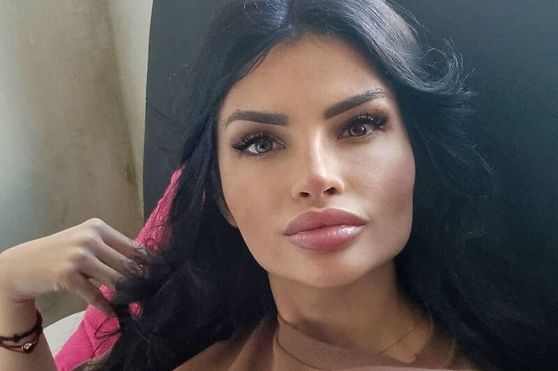 BARBI "DOKTORKA" OLGICA MARKANOVIĆ dobila nanogicu!