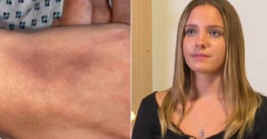 “UŽASNO JE POMISLITI ŠTA MI SE DOGODILO”: Djevojke prijavljuju novi način drogiranja u klubovima