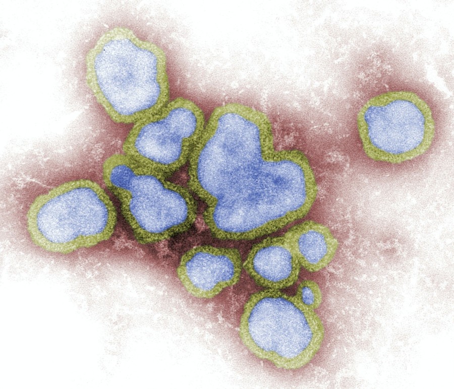 VIRUS OPASAN PO LJUDSKO ZDRAVLJE širi se Evropom i Azijom