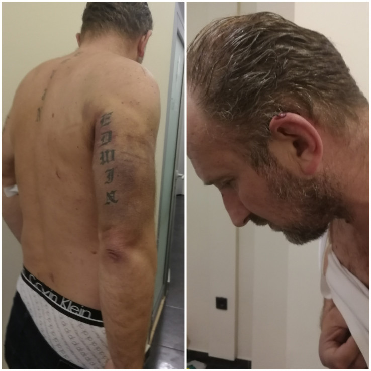 ENES DŽINOVIĆ: Dvanaest ljudi me cijelu noć tuklo palicama i nogama u Policijskoj upravi ŠIROKI BRIJEG! (FOTO)