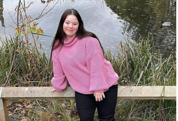BRAVO ZA GUČI! MODEL SA DAUNOVIM SINDROMOM plijeni pažnju širom svijeta (FOTO)