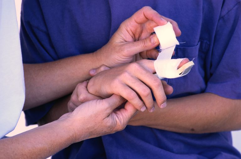 NIJE PRVI KOJI JE NASTRADAO: Tužio Mercedes zbog zgnječenog prsta