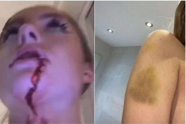 SVA KRVAVA I MODRA optužuje fudbalera za NASILJE! On još nije ODGOVORIO na optužbe (VIDEO)