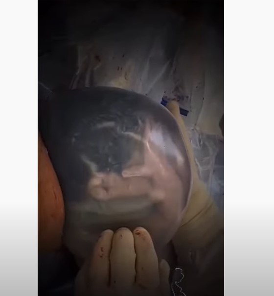 JEDAN U 80 HILJADA POROĐAJA: Pogledajte nesvakidašnji snimak BEBE rođene u VODENJAKU! (VIDEO)