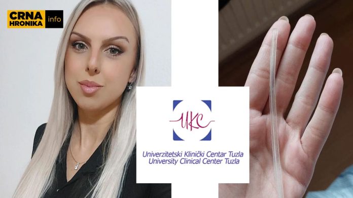JOŠ JEDAN SKANDAL TRESE ZDRAVSTVO BiH Djevojci u grudima NAKON OPERACIJE OSTALA silikonska cijev (FOTO)