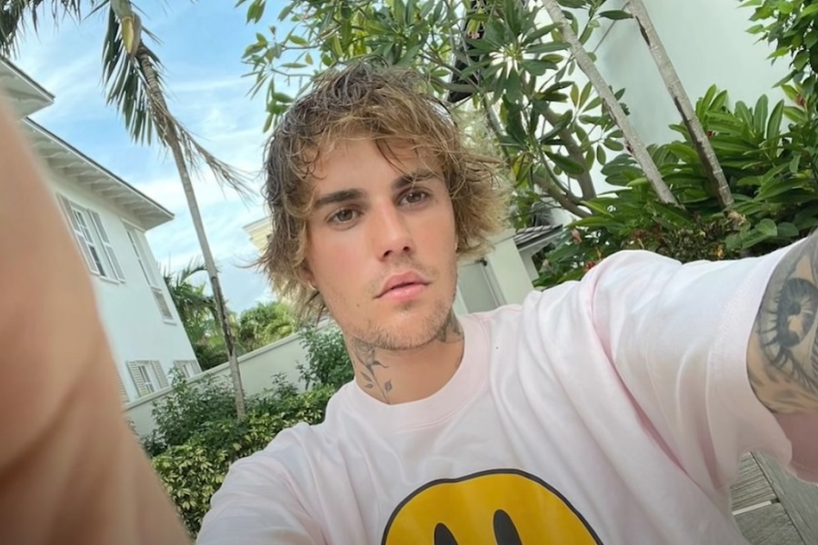 TIJELO MU GOVORI DA USPORI Džastinu Biberu dijagnostifikovan "Ramsay Hunt" sindrom