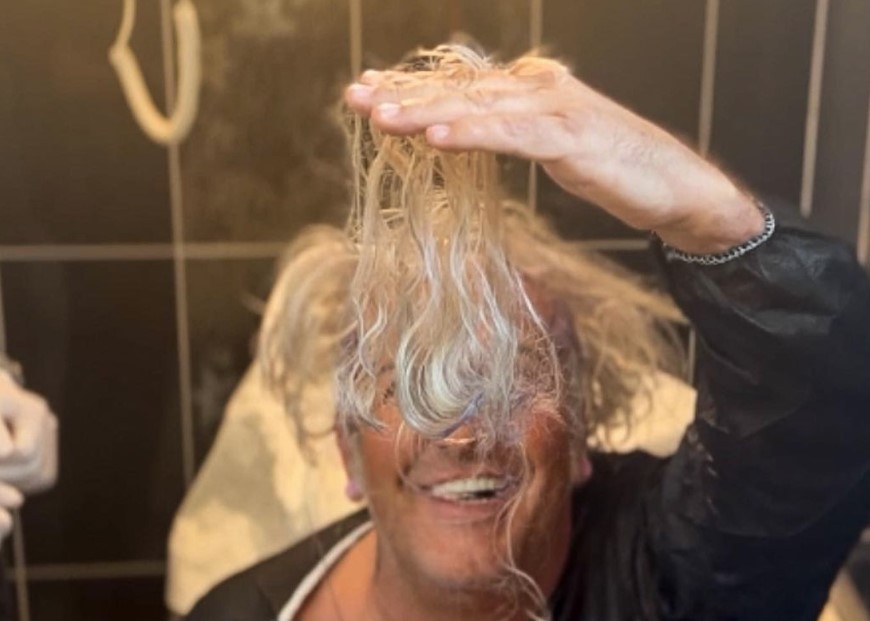 MACA OTIŠAO NA TRANSPLANTACIJU KOSE: Iznenadio fanove fotografijom (FOTO/VIDEO)