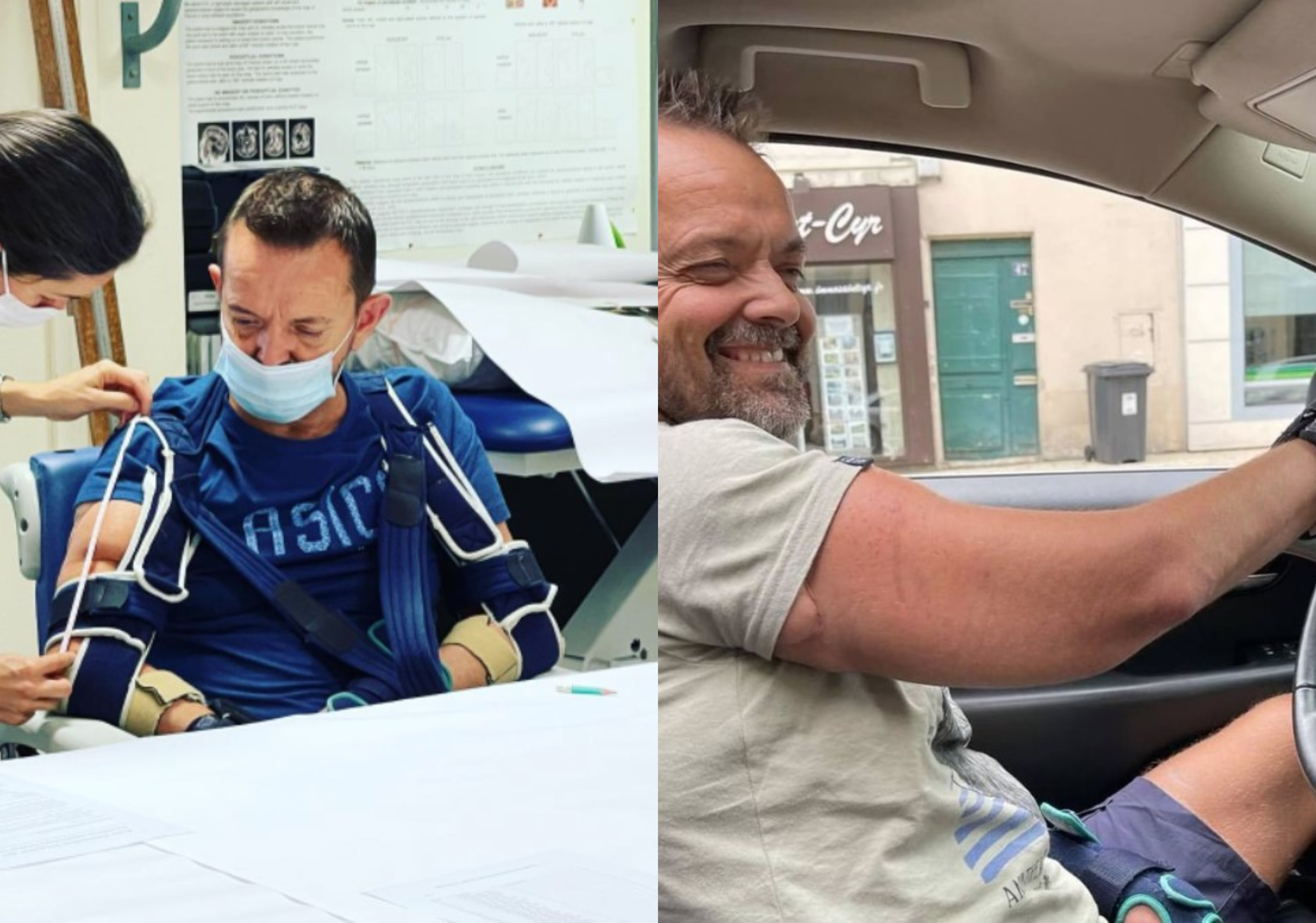 PRVA TRANSPLANTACIJA RUKU NA SVIJETU Pogledajte kako živi čovjek kojem su presađeni gornji ekstremiteti (FOTO/VIDEO)