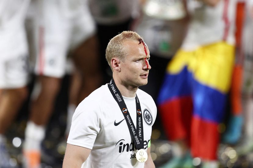 KRV MU TEKLA I DOK JE PRIMAO PEHAR Kapiten Ajntrahta sa otvorenom glavom igrao finale Lige Evrope (FOTO)