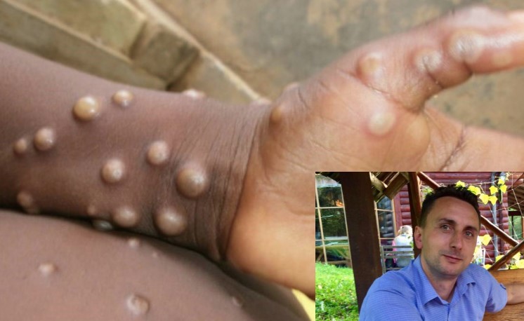 MAJMUNSKE BOGINJE STIGLE U KOMŠILUK Da li zbog dolaska dijaspore na odmor ima mjesta strahu i panici od širenja virusa u Srpskoj?