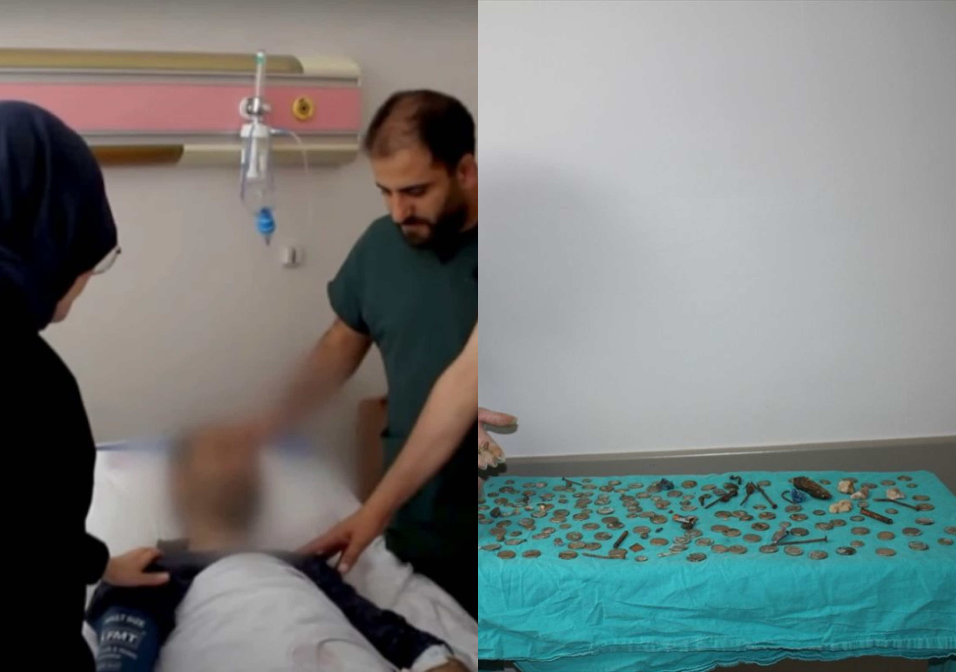 ČOVJEK JEO "DRVLJE I KAMENJE"! BIZARAN SLUČAJ OBIŠAO SVIJET Doktori u Turskoj iz stomaka pacijenta izvadili 233 strana predmeta