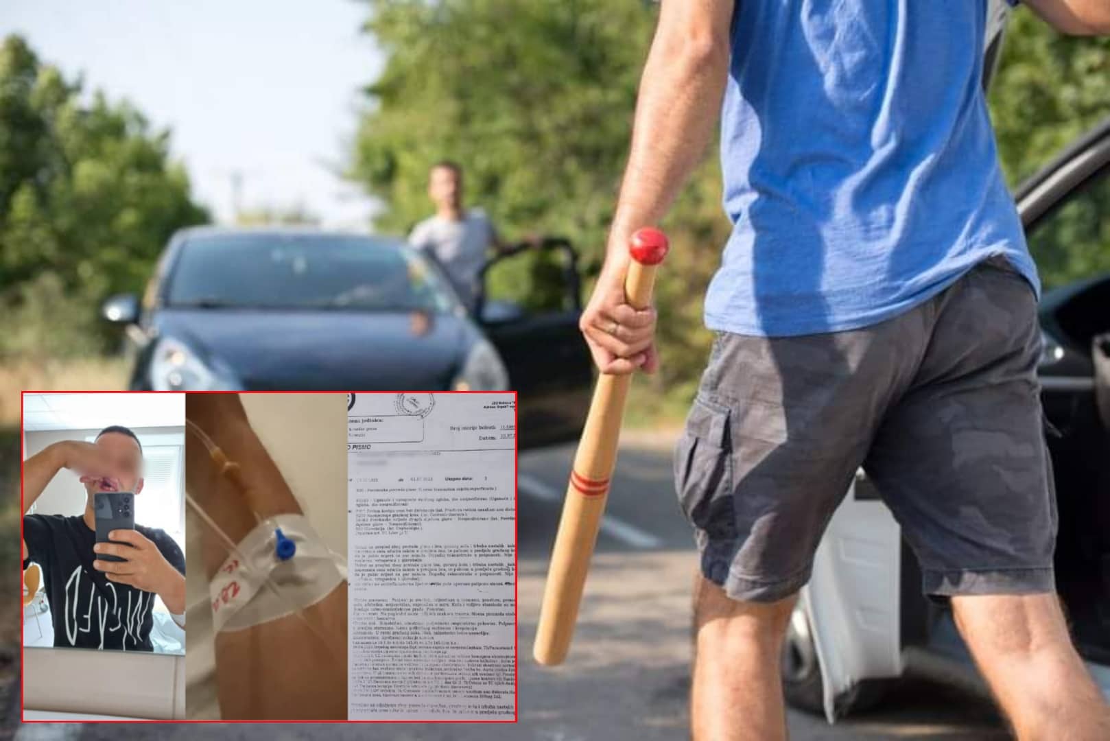 NEMILE SCENE NA PUTU KOD BIJELJINE Bejzbol palicom i šakama pretukao čovjeka pred njegovim maloljetnim sinom (16), dijete doživjelo traumu, otac završio u bolnici (FOTO)
