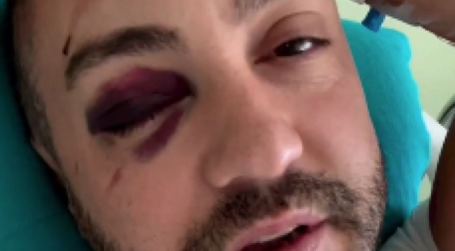 CRNOGORSKI KOMIČAR TEŠKO POVRIJEĐEN Ispričao vic Novaku Đokoviću i postao hit na društvenim mrežama (VIDEO)