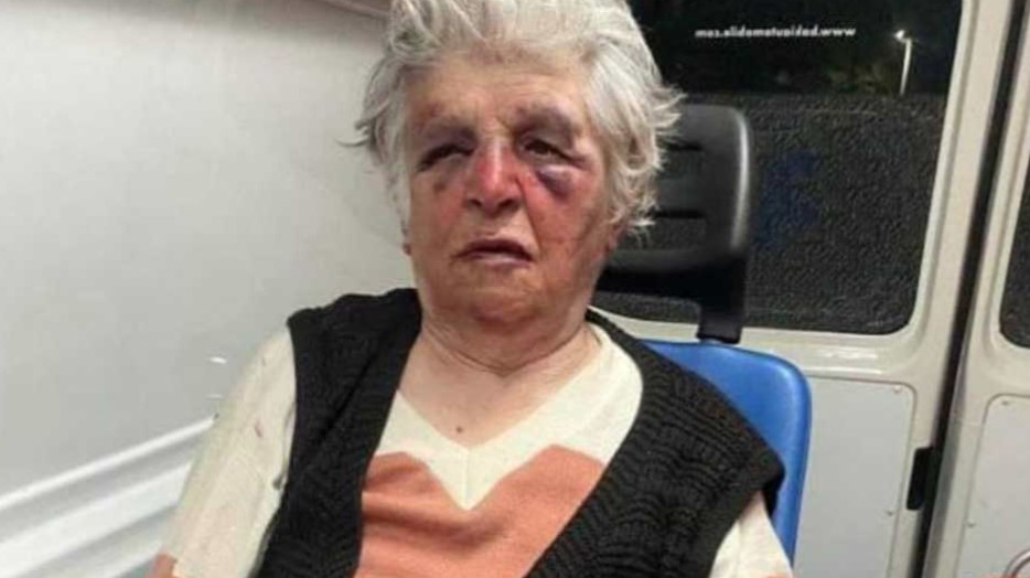 KRV JOJ IŠLA IZ OČIJU KOLIKO SU JE TUKLI Ispovijest unuke mučki prebijene bake na Kosovu