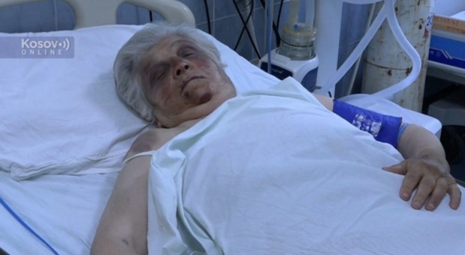 OGLASILA SE KRVNIČKI PRETUČENA BAKA BOŽANA IZ SJEVERNE MITROVICE: Tukli su me više od pola sata, htjeli su da me opljačkaju, a između sebe su pričali na albanskom (FOTO/VIDEO)
