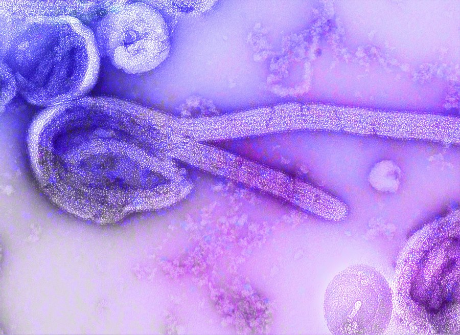 MUŠKARAC (24) PREMINUO: U Ugandi proglašena epidemija virusa ebole