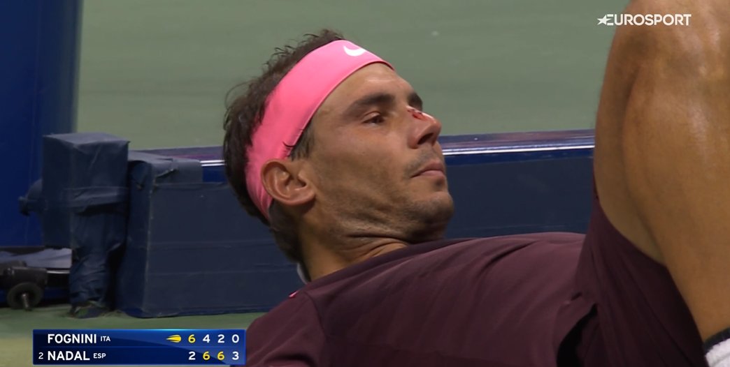 NADAL SPRIJEČIO VELIKI ŠOK Krvav završio posao za 3. kolo US Opena