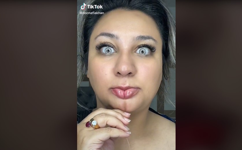 NOVI TREND ŠMINKANJA USANA Vidjeli na Fashion Week-u i odmah se „primili“: Sviđaju li vam se „pillow lips“? (FOTO)