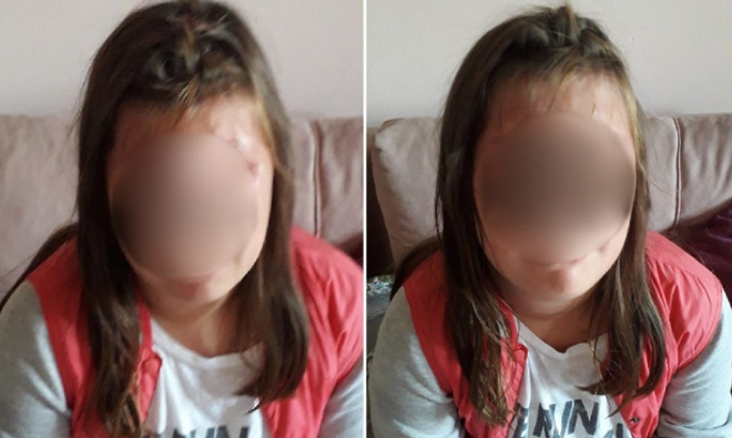 SLUČAJ KOJI JE POTRESAO BiH Djevojčicu iz Maglaja vršnjaci tukli bokserom i flašama!