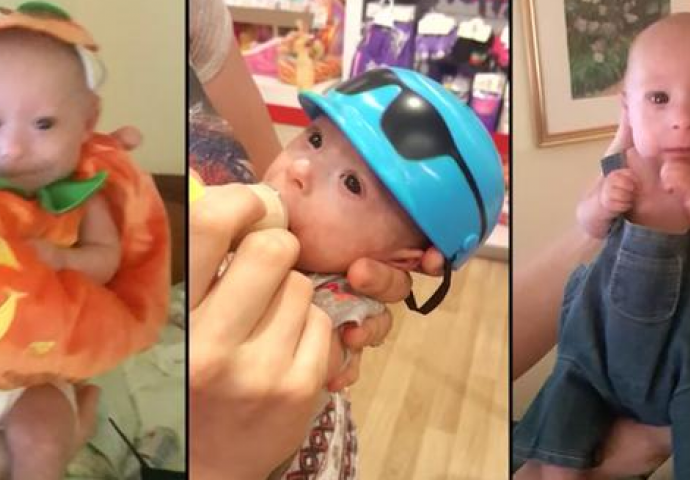 IMA 7 MJESECI, A NOSI ODJEĆU ZA LUTKE "Mali princ" rođen sa samo 450 grama pravi je fenomen (FOTO)