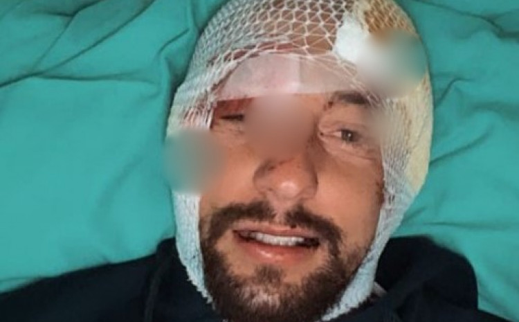 BIVŠI ZADRUGAR DOŽIVIO TEŠKU SAOBRAĆAJKU Automobil nakon nesreće totalno slupan, završio na krovu (FOTO)