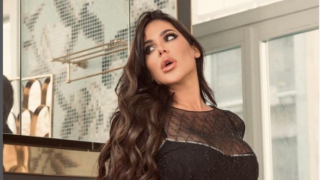 Šta joj se dogodilo: Marina Visković sva u opekotinama (FOTO)