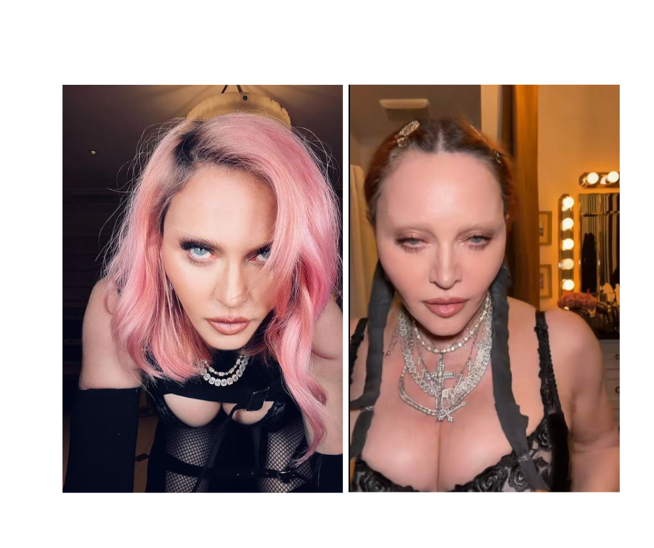 MADONA SNIMKOM ZGROZILA JAVNOST Fanovi širom svijeta zabrinuti za pop divu: "Jesu joj uradili lobotomiju" (VIDEO)