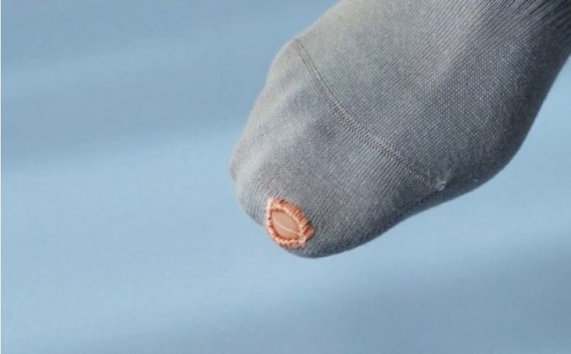 EVO RJEŠENJA! Poderala vam se čarapa? Izujte se slobodno, to nije rupa, to je moda! (FOTO)
