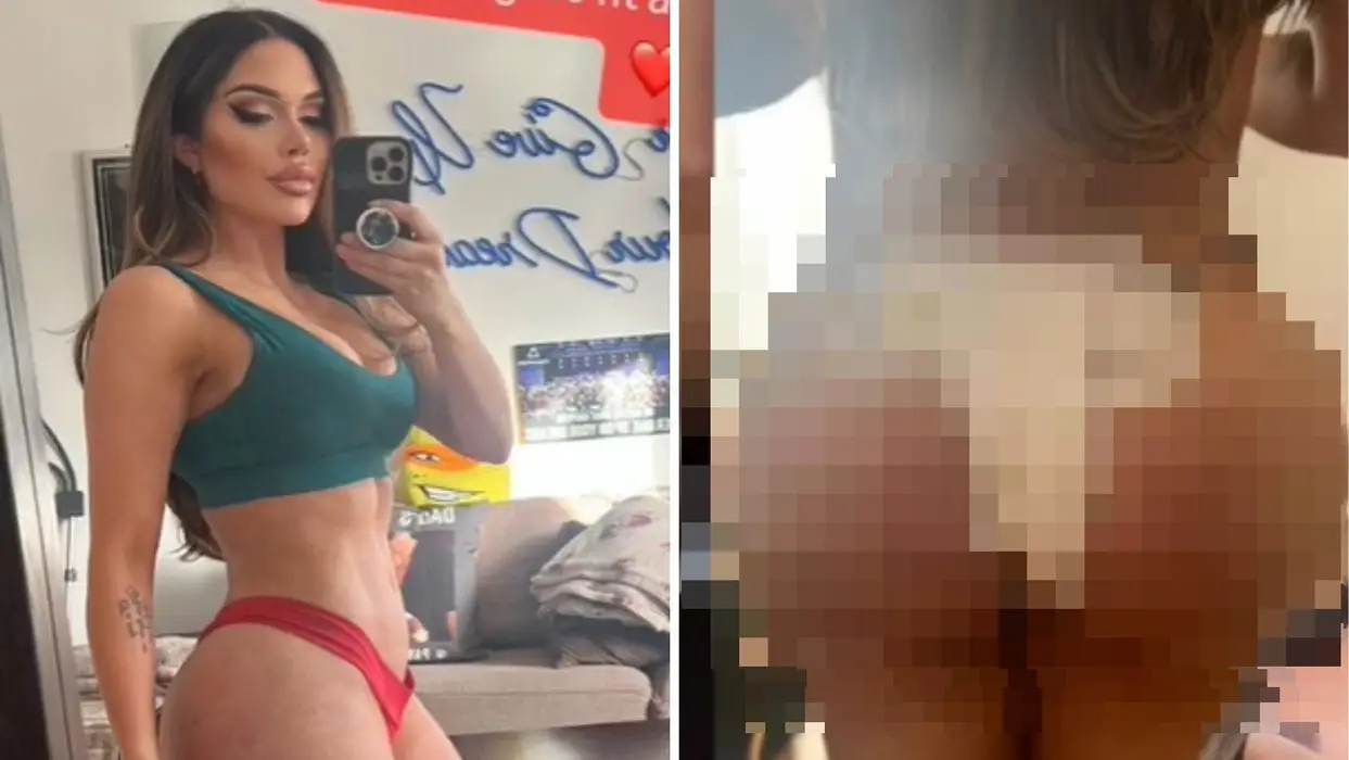 CIJENU LJEPOTE SKUPO PLATILA Otišla na operaciju stražnjice, pa završila neslavno: "Cijela sam razderana otpozadi" (VIDEO)