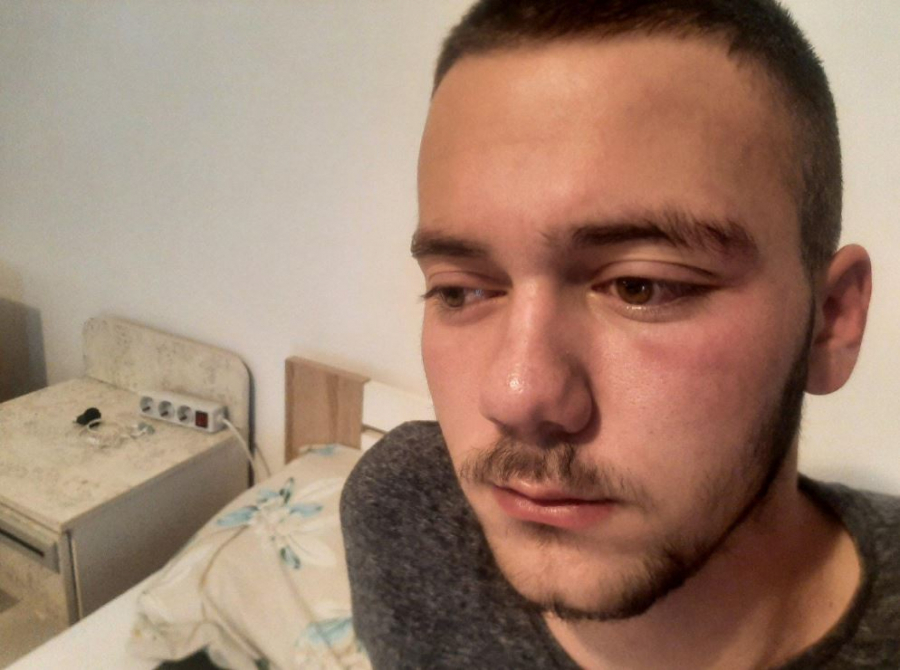 BOG SVE VIDI! Novi napad na srpsku djecu, Albanci pretukli dječaka iz Klokota kad se vraćao sa liturgije (FOTO)