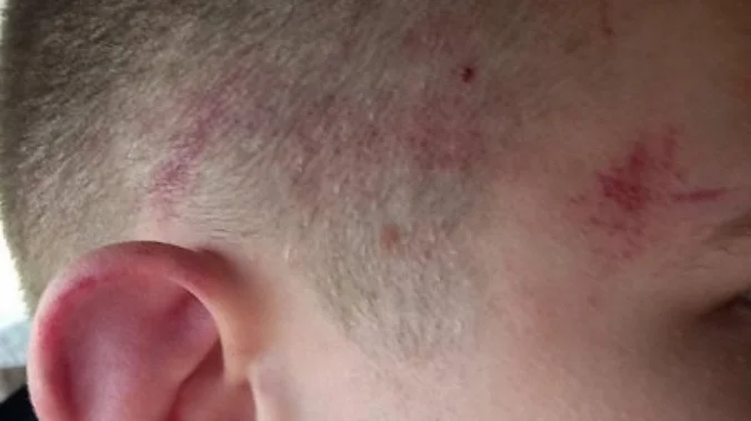 ČETIRI ALBANCA PRETUKLA LAZARA Još jedno srpsko dete na meti albanskih ekstremista