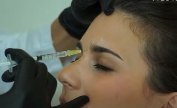 BOTOKSOM PROTIV MIGRENE? Neočekivani tretman pomaže kod hronične glavobolje