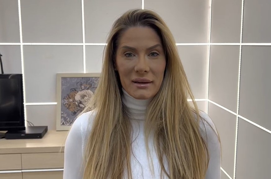 PROCURILE FOTKE ANE ĆURČIĆ PRIJE PLASTIČNIH OPERACIJA Neprepoznatljiva je, najviše je radila na licu