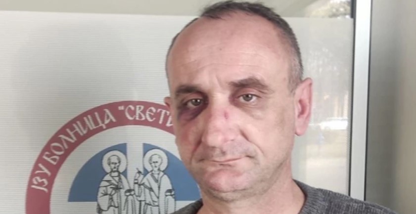 SDS-ovci SE OBRAČUNALI U VIKENDICI Grujičić: Pretukao me direktor Vodovoda! Ne dam mu dvije funkcije!