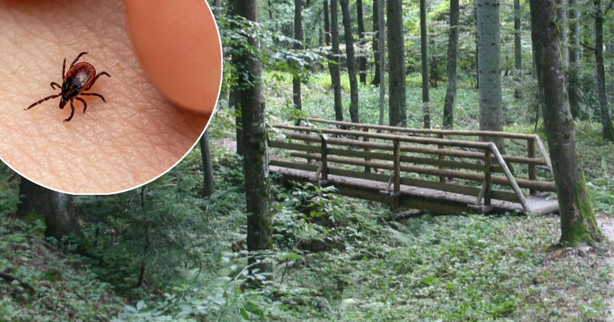 "LJEKARI SU REKLI DA JE SVE U REDU, A ZAVRŠILA SAM SA ŠAVOVIMA I OŽILJKOM NA RUCI" Sve što treba znati o krpeljima i kako se zaštiti od ovih opasnih parazita!