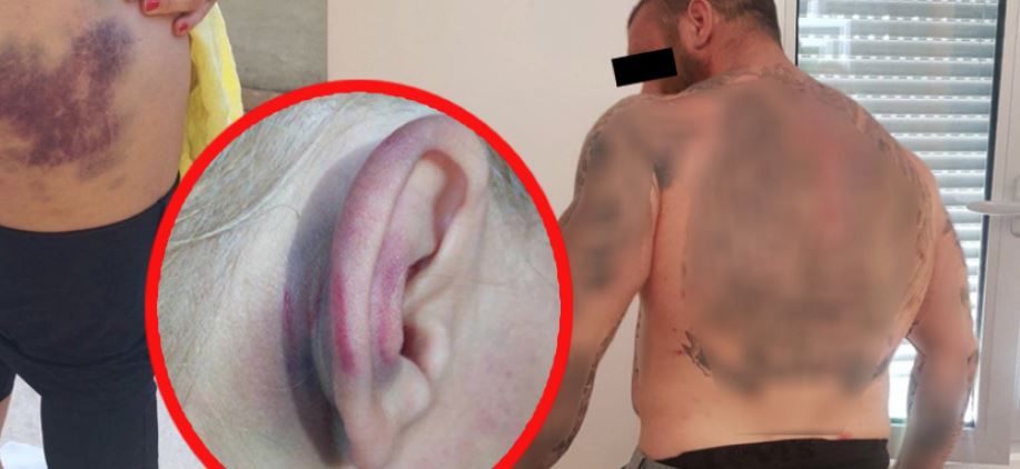 (UZNEMIRUJUĆE FOTOGRAFIJE) STRAVIČNO NASILJE U BEOGRADU Godinama tukao ženu, a onda rođenoj braći pištoljem polomio lobanje i nos: Specijalci sa dugim cijevima hapsili nasilnika