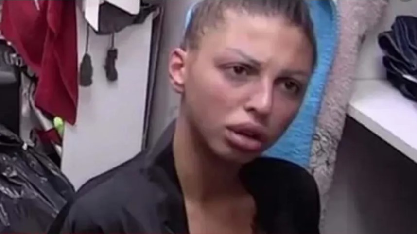 DA LI JE PREPOZNAJETE? Ona je dokaz moći plastične hirurgije (FOTO)