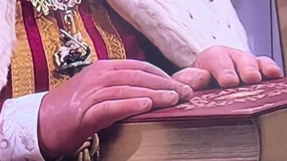 "PRSTI KAO KOBASICE" Fotografija otečenih šaka kralja Čarlsa uzrokovala zabrinutost za njegovo zdravlje (VIDEO)