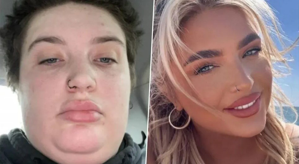 SMRŠALA VIŠE OD 45 KILOGRAMA Njena transformacija oduševila sve, ne mogu je prepoznati (FOTO)