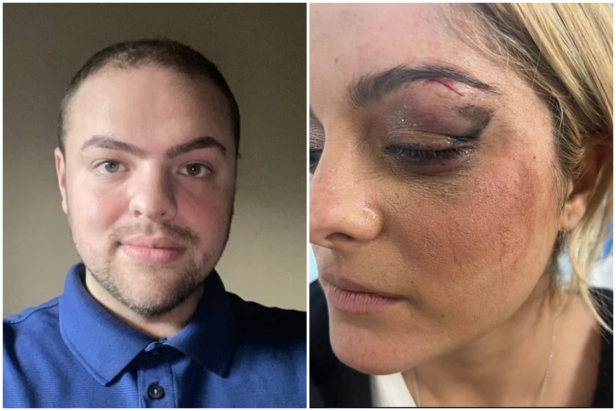 OGLASIO SE MOMAK KOJI JE RAZBIO GLAVU ALBANSKOJ PJEVAČICI "Pokušavao sam da vidim da li mogu da je pogodim“