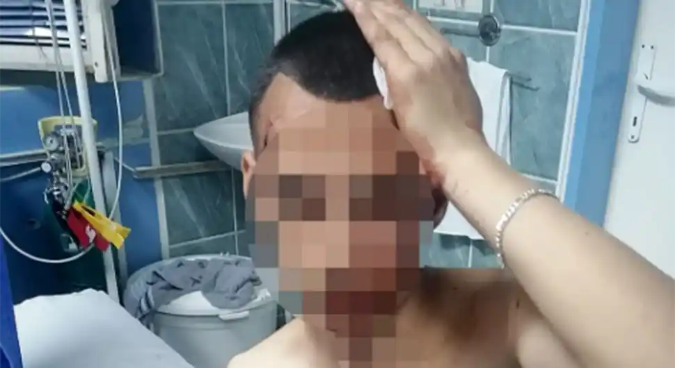 IZ ČISTA MIRA Dva mladića brutalno pretukla kaišem dječaka dok je šetao sa sestrom
